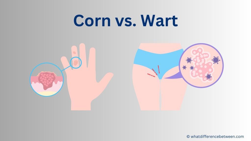 difference between Corn and Wart